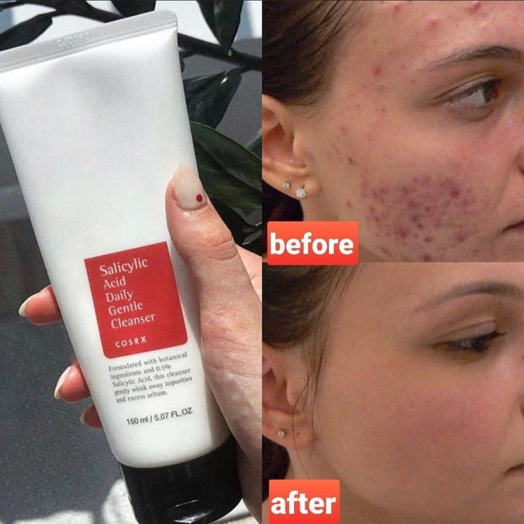 Salicylic Acid Daily Gentle Cleanser